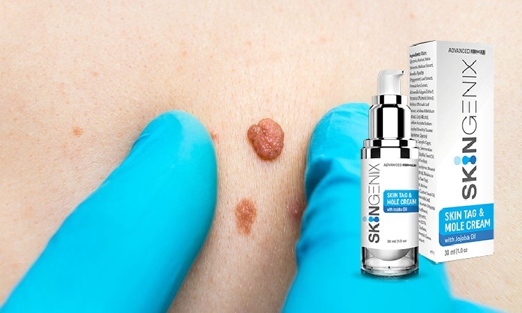 Skingenix Ingredients - Advanced Skin Tags Removal, Remove Tags in Less Than Six Hours